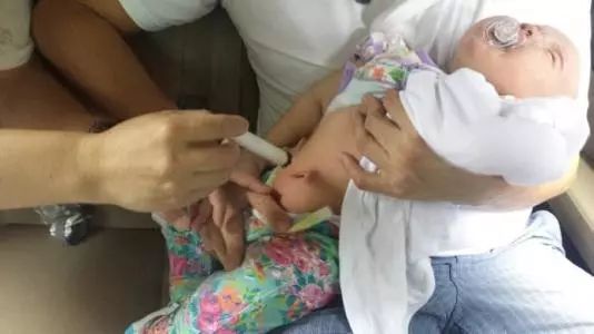 小儿腹泻艾灸治疗方法,艾灸小儿腹泻穴位