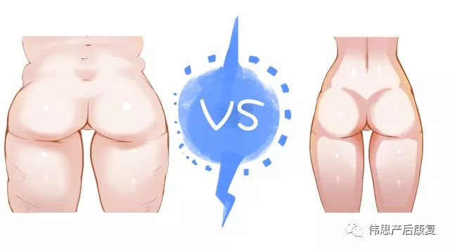 产后翘臀的正确方法,产后蜜糖臀和扁平臀