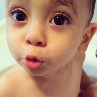 宝宝感冒咳嗽厉害脸上有几个红点,小孩感冒咳嗽脸上起红疹子