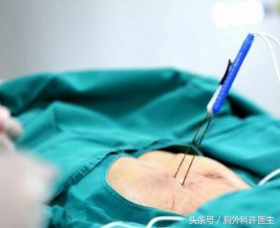 肺癌治疗仪器,肺癌手术器械