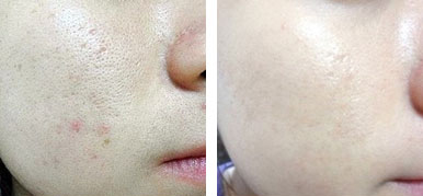 超级好用的护肤品,好用的改善皮肤的护肤品