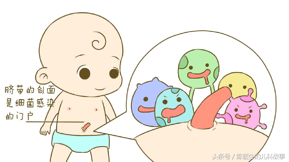 育婴师新生儿脐部护理实操,新生儿脐部护理的图片