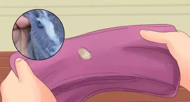 最近感觉内裤老有白带糊状,白带多的裤子都湿了怎么回事