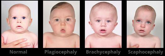 女生扁头怎么拯救,拿什么拯救你的图片