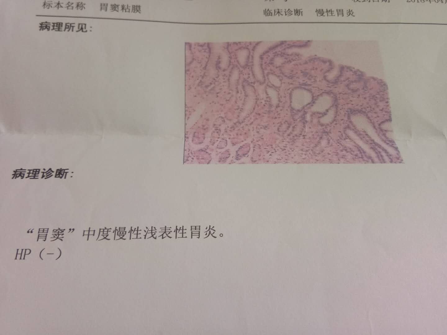 战胜萎缩胃炎,战胜胃病的故事