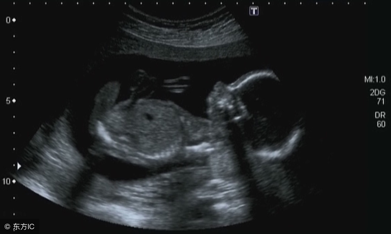 孕1-40周b超对照表,0-40周胎儿b超对照表