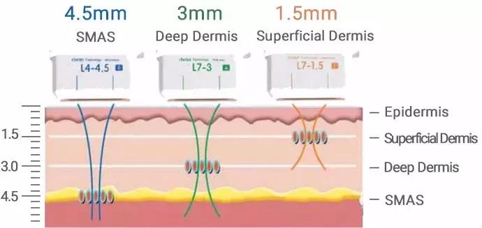 几千块钱做的超声刀，想要逆龄反被毁容？！