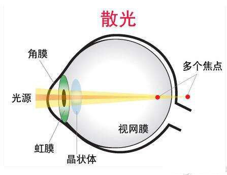 学校给孩子体检的视力散光准确吗,幼儿园体检发现近视或散光怎么办