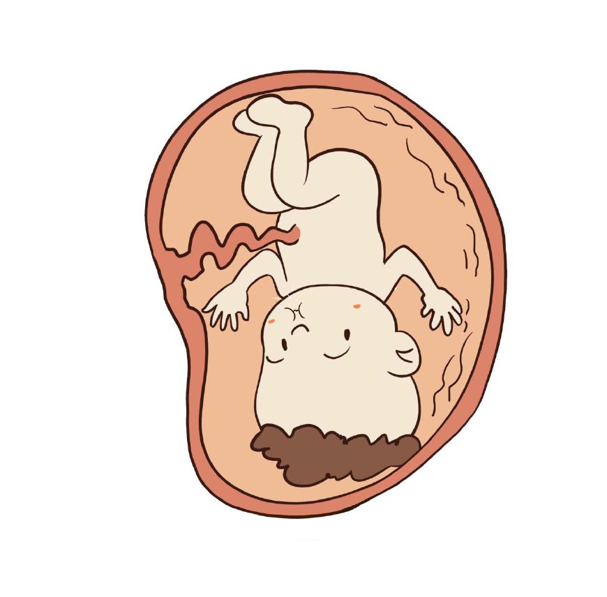 做b超的时候宝宝在干嘛,孕妈妈做b超时宝宝在干嘛