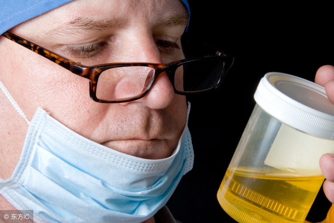 小便泡沫久久不消失一定是疾病吗,小便泡沫多是什么疾病