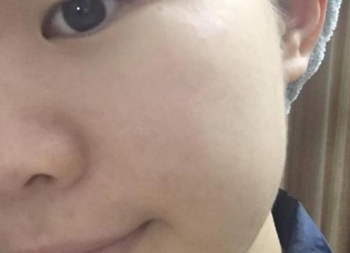 Ray面膜已经火遍世界了,各路明星都在用,别说你还没用过?