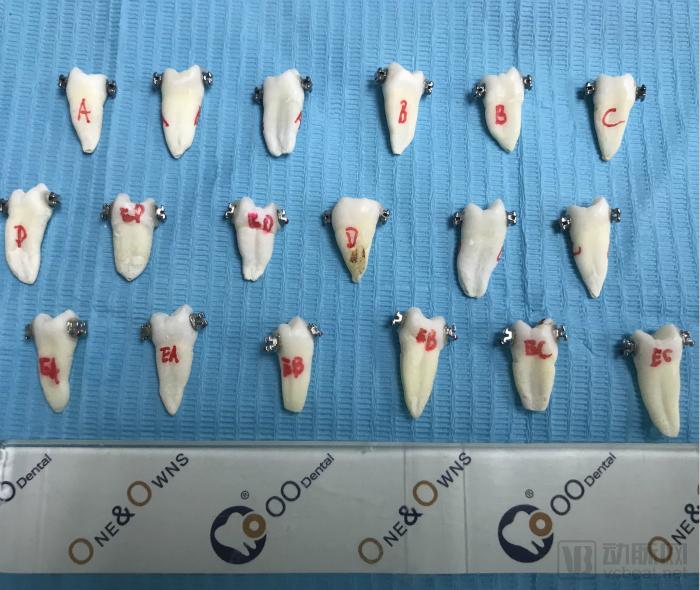 牙科医生卖掉诊所创业，这家托槽企业如何“抢食”国外大牌份额？