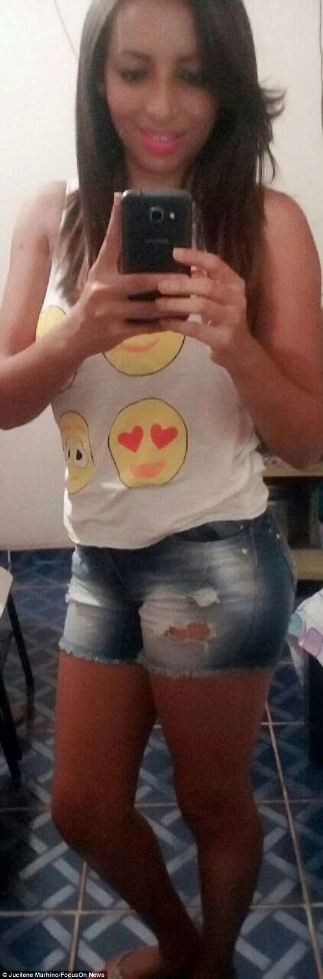 巴西女子天生没有阴道,成功手术安装鱼皮阴道,系全球首例