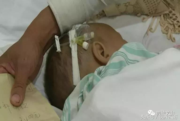 八岁小孩被砍断双手送到医院,8岁孩子被亲爹砍伤