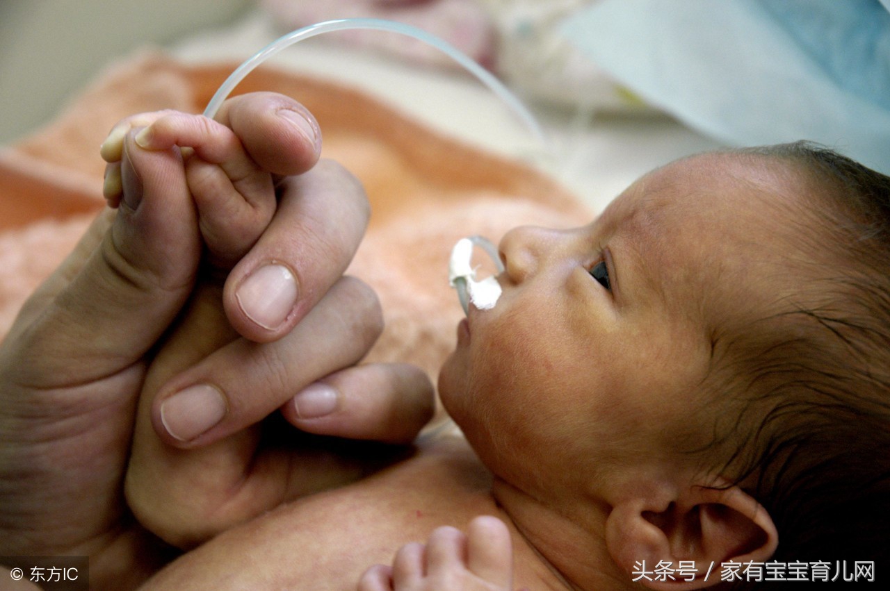 警惕!早产儿会有很多并发症的可能!如何避免?