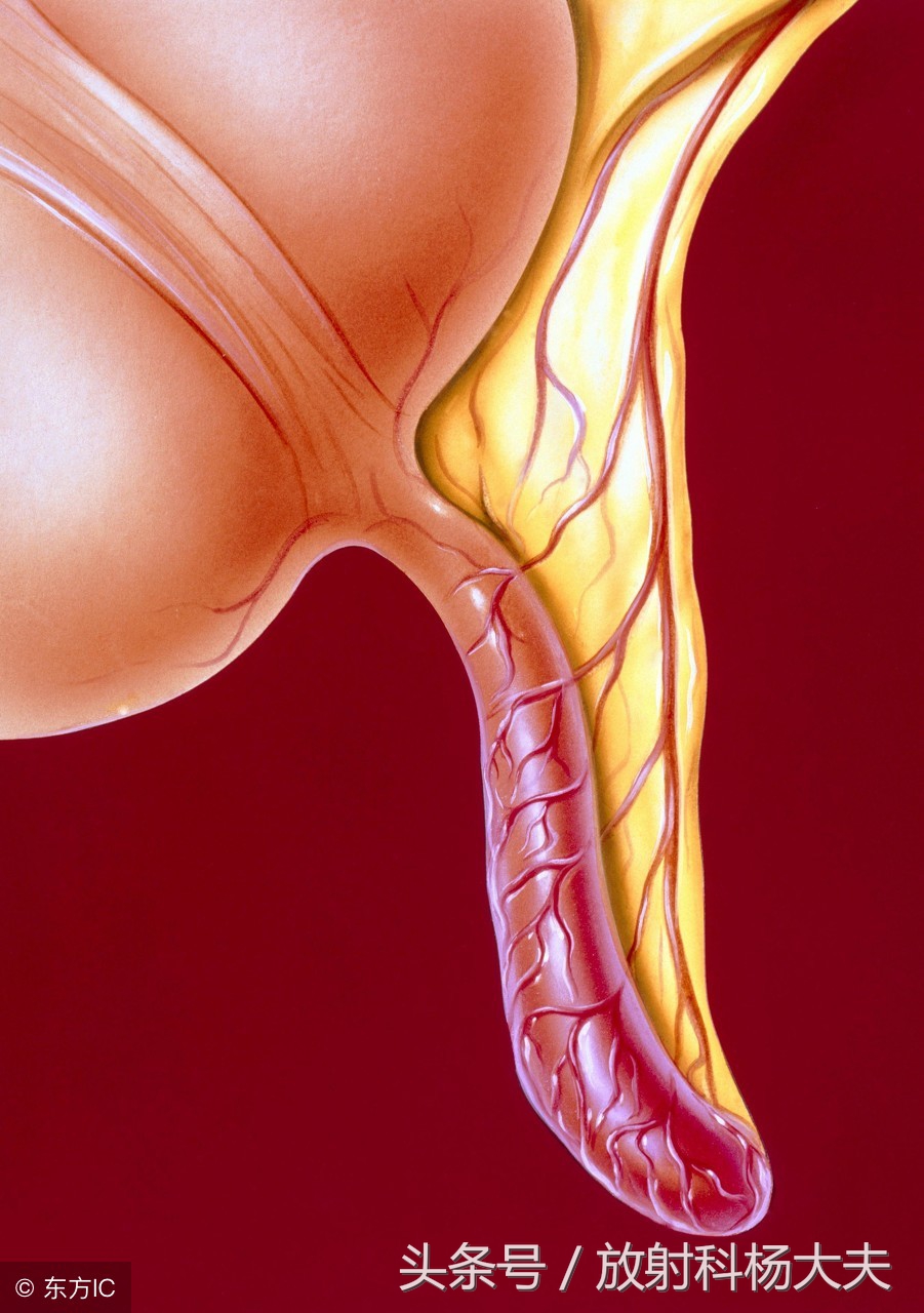 刚做完腰部ct发现怀孕了能不能要,一个月前做的ct现在怀孕有影响么