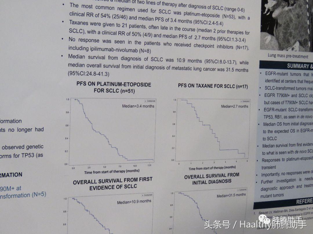 2018ASCO｜“转化治疗”只能坐以待毙？来看看它的疗效如何？