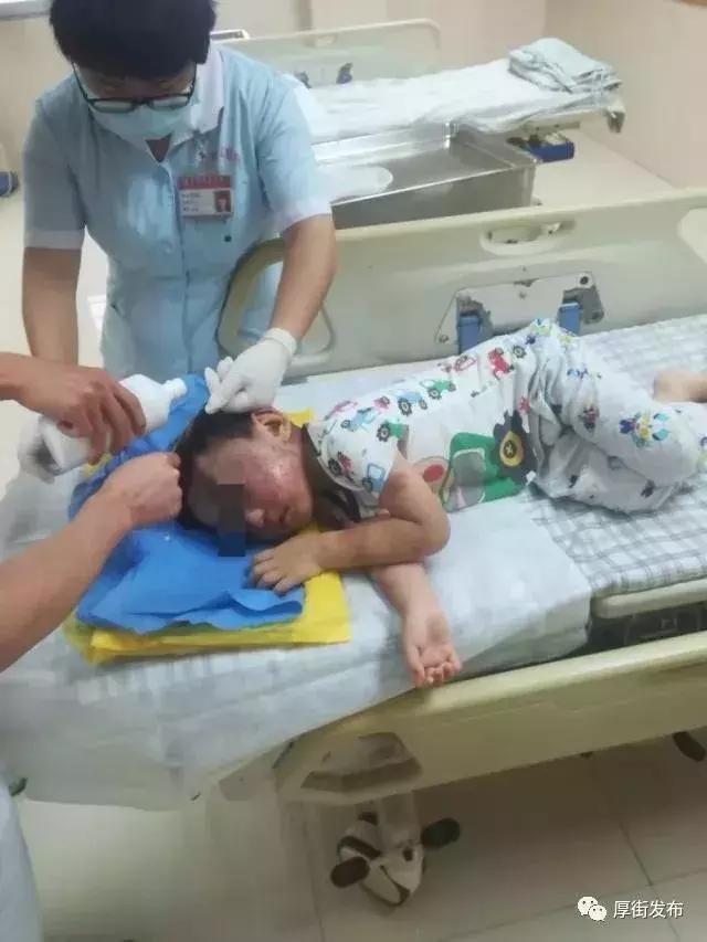4岁男孩被打满身伤痕,小孩被父母暴打脸打肿