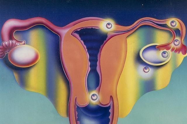 宫外孕后是不是很容易再次宫外孕,宫外孕之后如何避免再次宫外孕