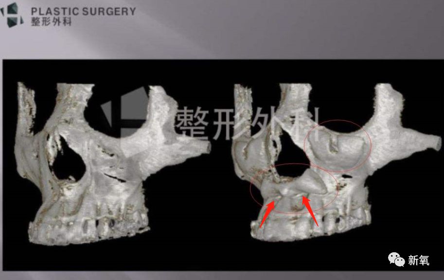 迪丽热巴被p图事件回应,迪丽热巴被p图的视频