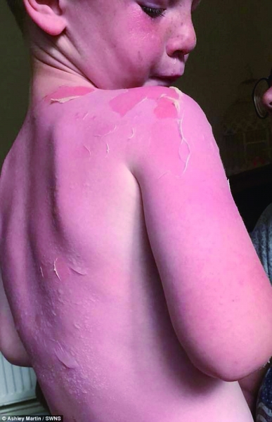 香蕉船死亡事件后续,香蕉船被撞后续