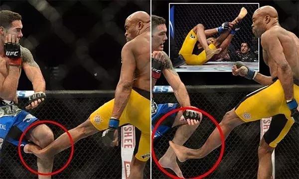 又一起断腿惨剧！“日本选手”竟是中国特种兵！