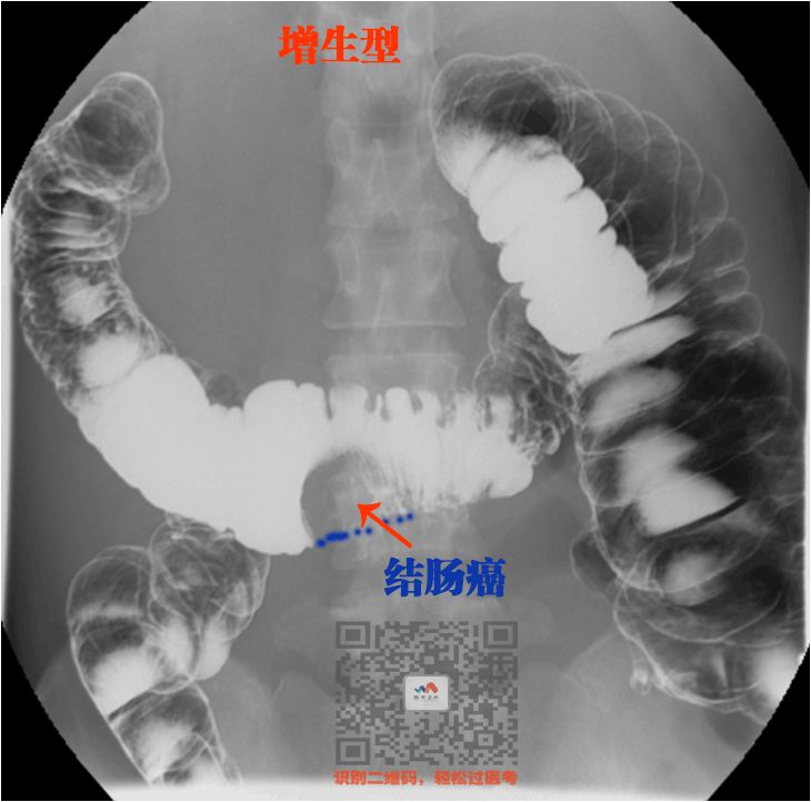 执医技能：X线阅片，全是套路，超简单