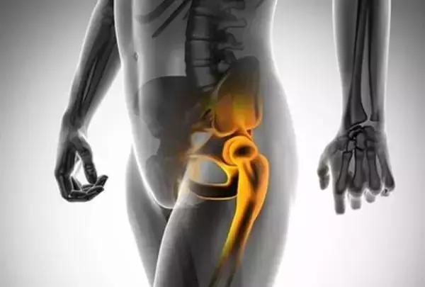 老年人关节老化需要做手术吗,老年人关节老化要动手术吗