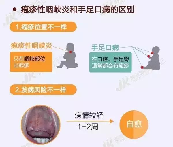 小孩发烧嘴里起泡有疹子,小孩发烧流感嘴巴起了好多溃疡