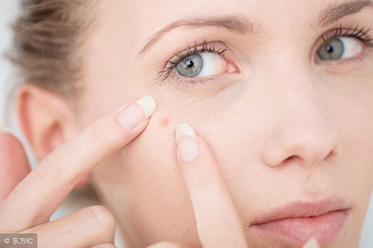 长痘可以用水乳吗,长痘怎么办