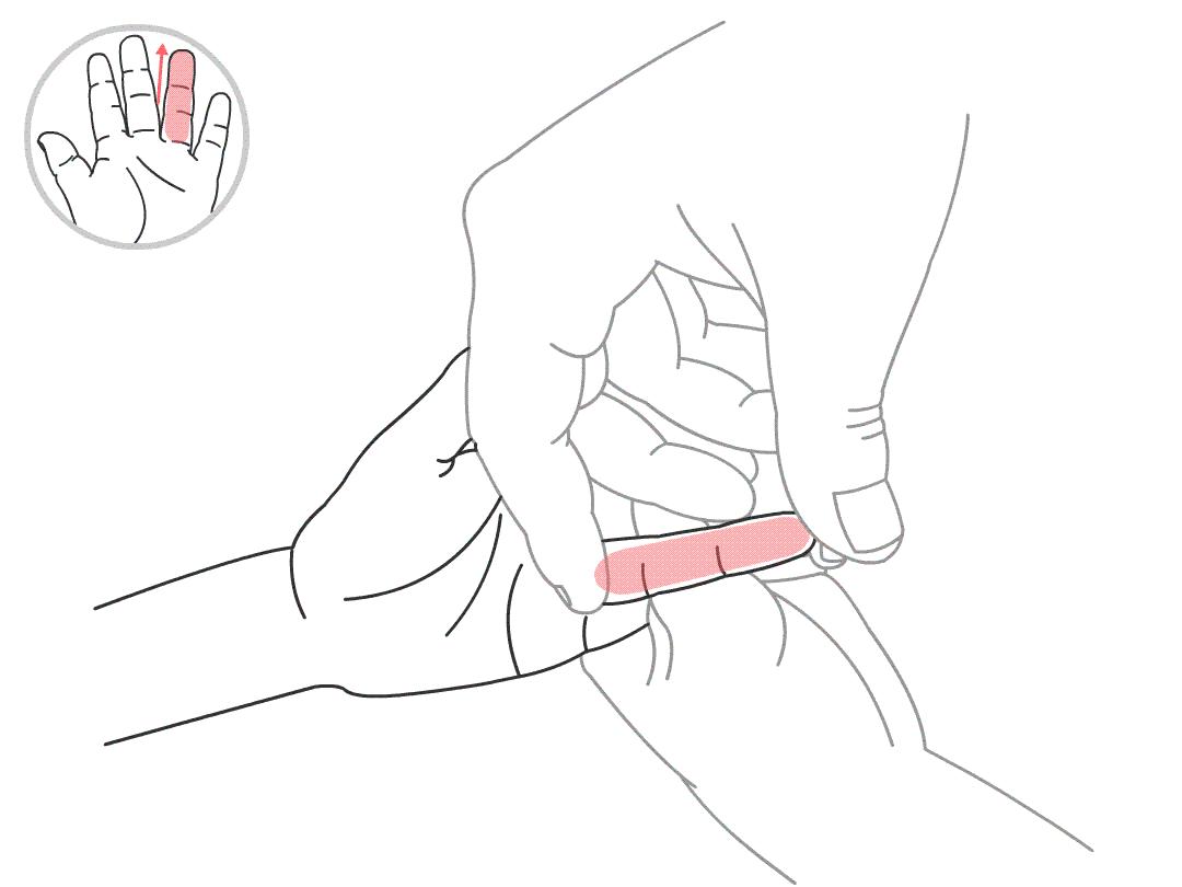 小儿发烧后咳嗽不止怎么办,孩子感冒咳嗽不止怎么办