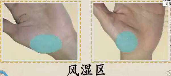 手的健康识别,手型看健康