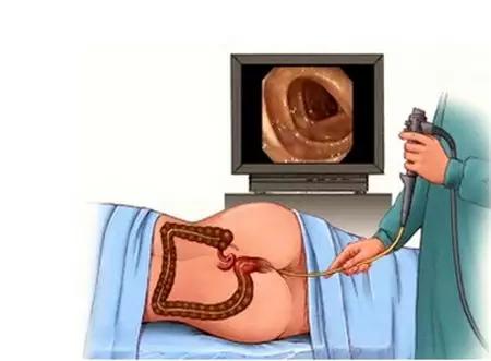 嘴唇上有黑斑是有癌症了吗,嘴唇有黑斑是肠道有病吗