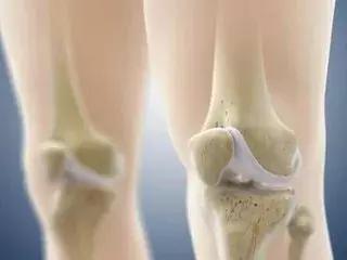 最好喝的几款碳酸饮料,最常见的碳酸饮料