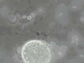 一直以为自己是跑得最快的那颗精子，原来并不是……