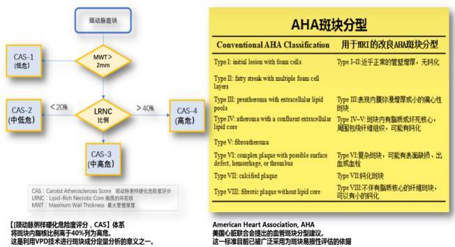 识别易损斑块方法,从了解到熟练五个阶段