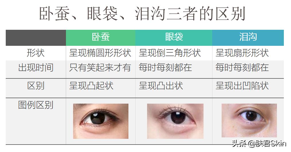 有什么沟必须火的,泪沟后面有一条很深的沟叫什么