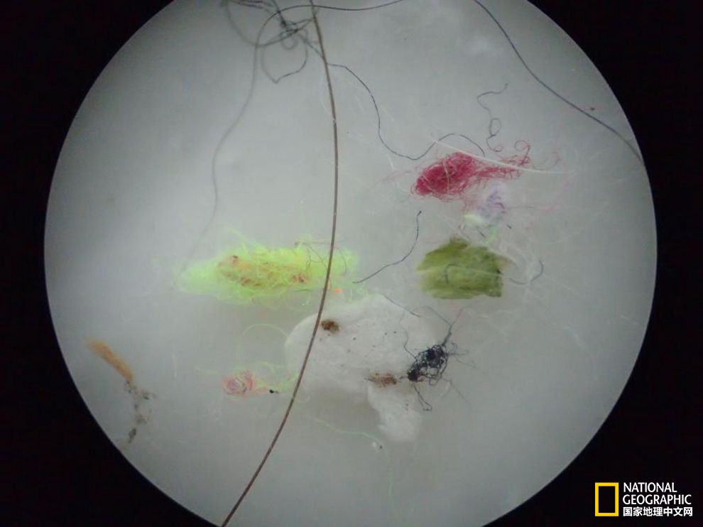 患者体内有寄生虫是什么感觉,体内有寄生虫身体会出现什么症状