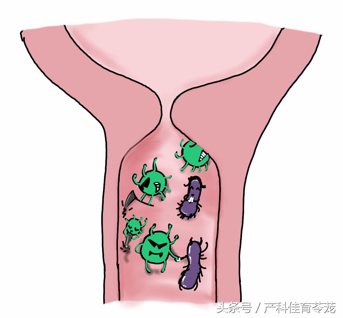 得过支原体是否容易再犯,针对支原体的药