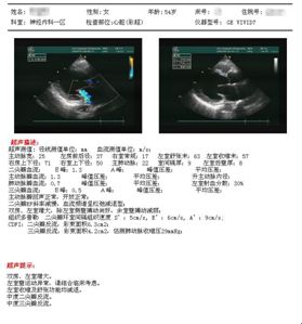 基底动脉闭合手术,基底动脉闭塞取栓一直昏睡