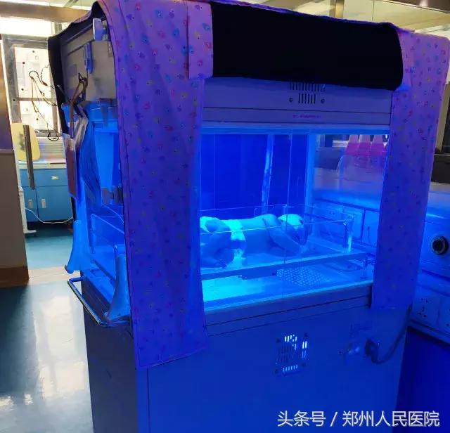 新生儿黄疸不用蓝光照会消失吗,黄疸不住院照蓝光可以吗