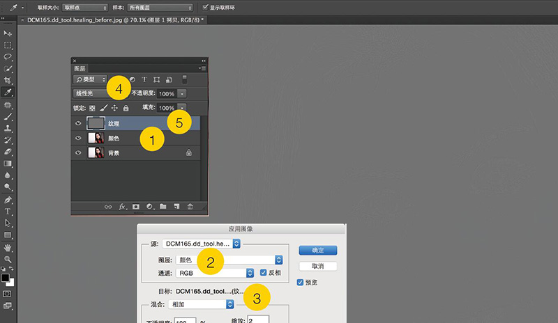 皮肤去痕修复神器,修复皮肤印痕方法