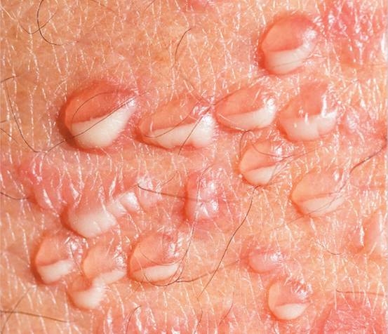 阴茎纹身还有这用处？医生应该见识的22个奇葩病例