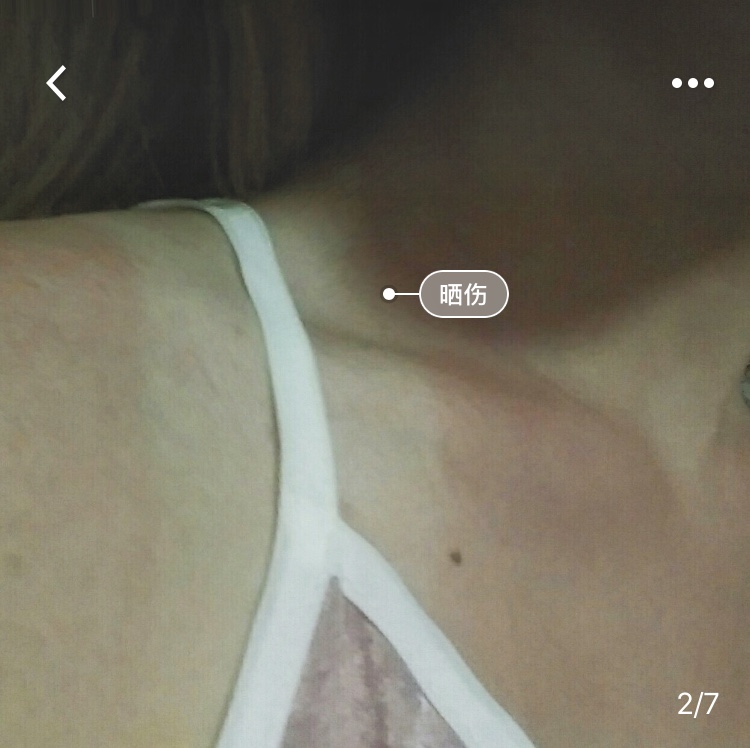 学车不用担心被晒黑,夏季学车怕晒黑怎么办