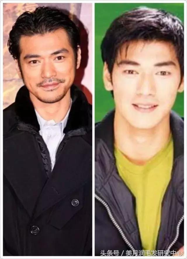 大额头怎么拥有完美发际线,发际线干货分享