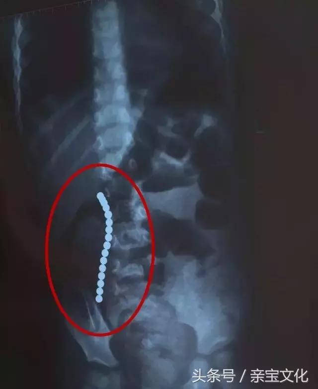 2岁女宝吐了十几次,2岁儿童一天吐10次