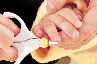 宝宝把脸抓烂了怎么可以盖住,宝宝经常抓脸脸抓破了