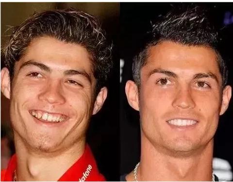 c罗容貌的变化,c罗整牙颜值变化