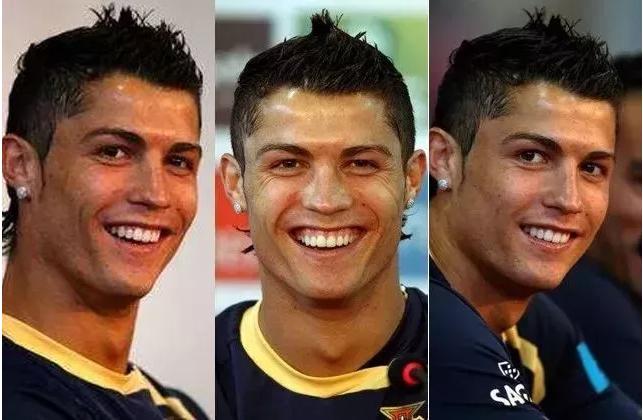c罗整容了吗,c罗整牙颜值变化