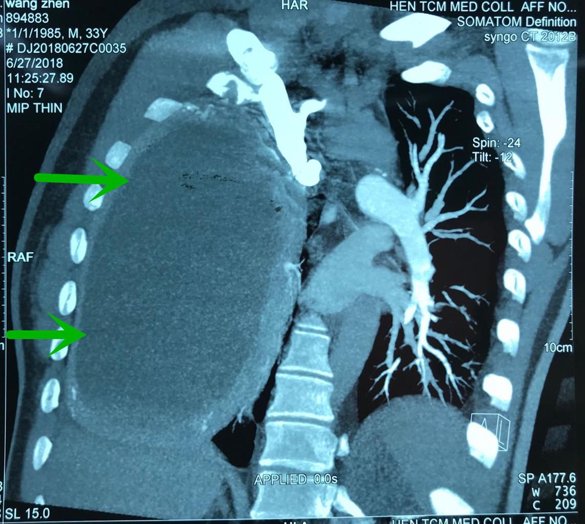 郑大一附院河医区手术室,河大一附院手术室